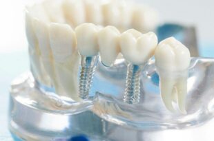 Протезирование зубов – это повышения качества жизни